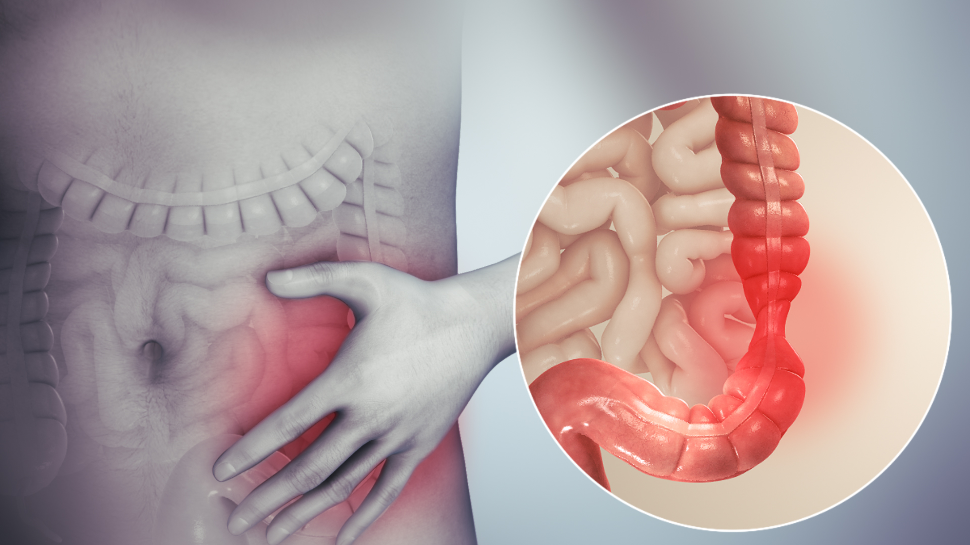 یک راهکار عالی برای سلامتی روده‌ها