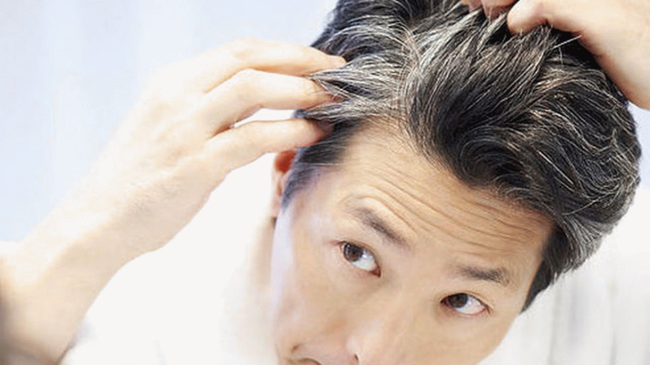 کندن موهای سفید خطر ابتلا به زخم و عفونت را افزایش می‌دهد