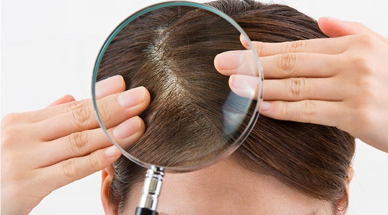 «اشعه خورشید، ساقه مو را می‌پزد! / روش های طبیعی برای سالم نگهداشتن مو در تابستان