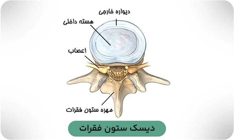 تصویری از داخل دیسک و نمایش قسمت داخلی و حلقه.